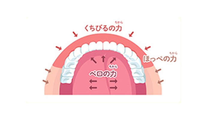 目立たないマウスピース矯正